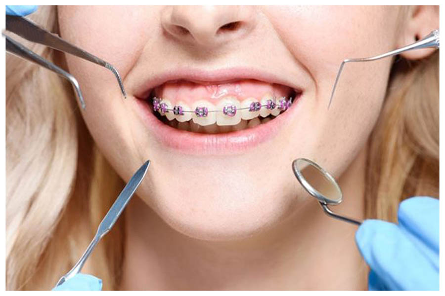 Chỉnh nha là gì Chỉnh nha là gì