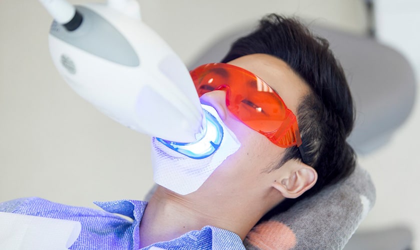 Công nghệ tẩy trắng răng Laser Whitening