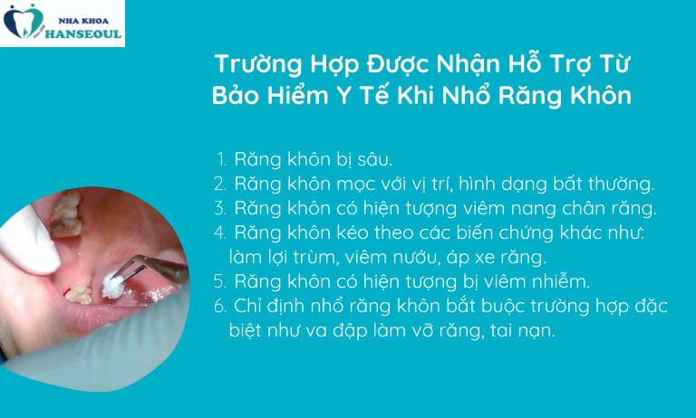 Nhổ răng khôn được hỗ trợ bảo hiểm y tế chi phí nhổ răng khôn có bảo hiểm y tế