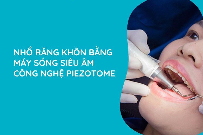 Công nghệ nhổ răng khôn piezotome Công nghệ nhổ răng khôn piezotome