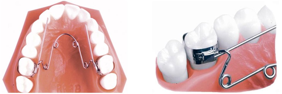 Thiết bị nong hàm Thiết bị nong hàm