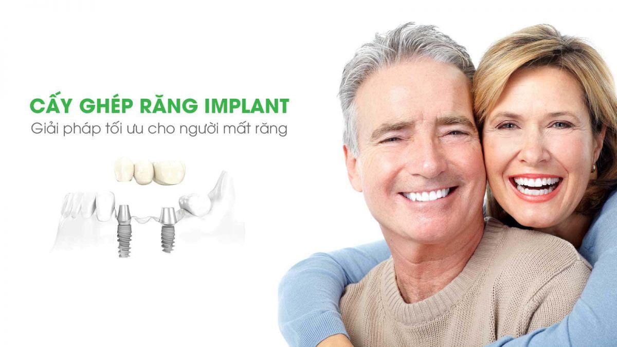 nhung-ai-nen-cay-ghep-implant