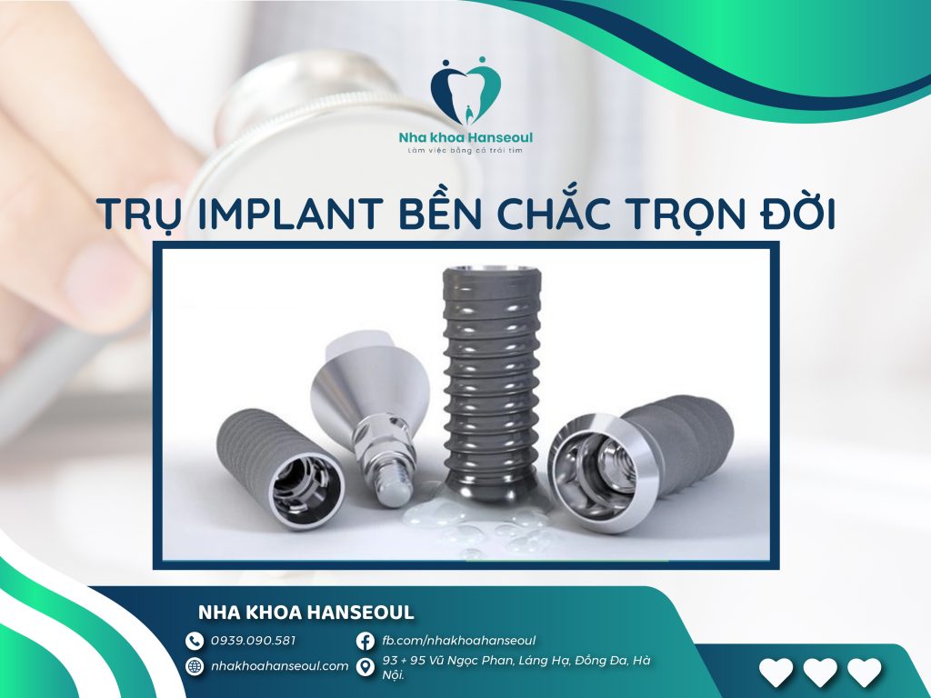 loại trụ implant phổ biến nhất hiện nay