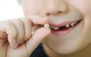 có nên nhổ răng sữa chưa lung lay không